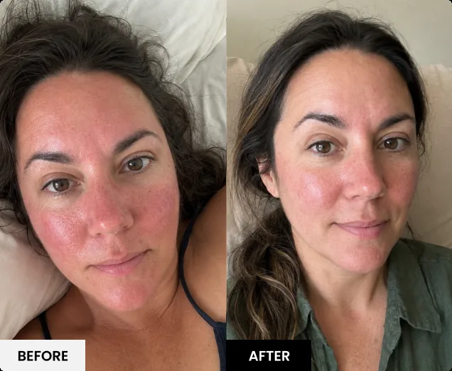 Before and after skin result 2