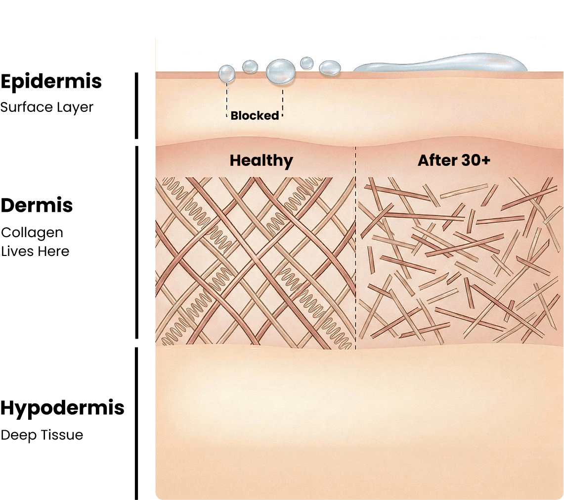 Skin layers diagram: epidermis, dermis, hypodermis; creams on surface, blocked, healthy and after 30+ in dermis