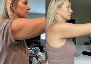 Customer before and after