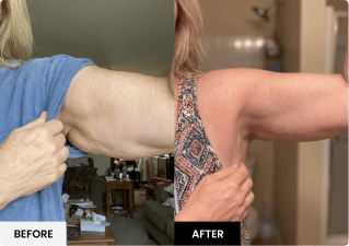 Customer before and after