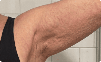 Week 1&ndash;2: skin texture progress