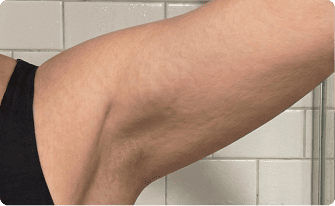 Week 3&ndash;4: visible tightening